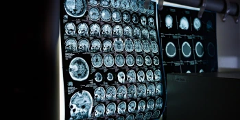 Dématérialisation des services administratifs médicaux : une mutation en cours, toutefois précaire.
