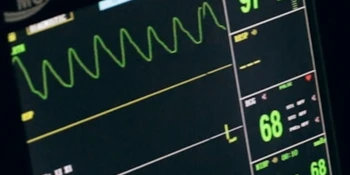 Mutation numérique des structures de santé françaises : oscillant entre l\'expansion de l\'intelligence artificielle et la résistance des dispositifs existants.
